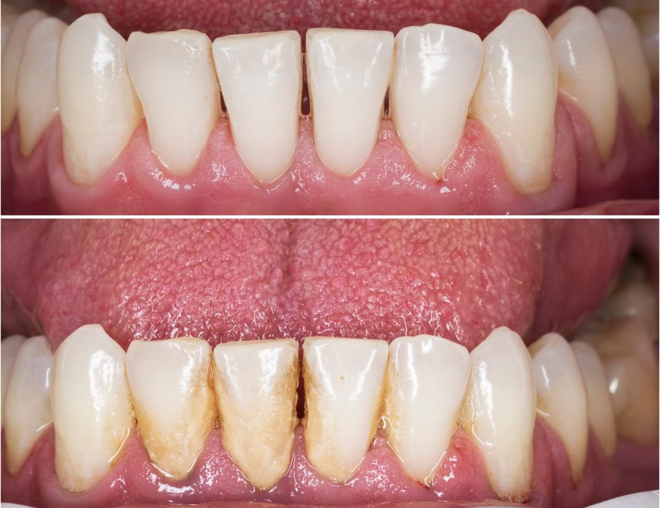Demonstração Antes e Depois 2
