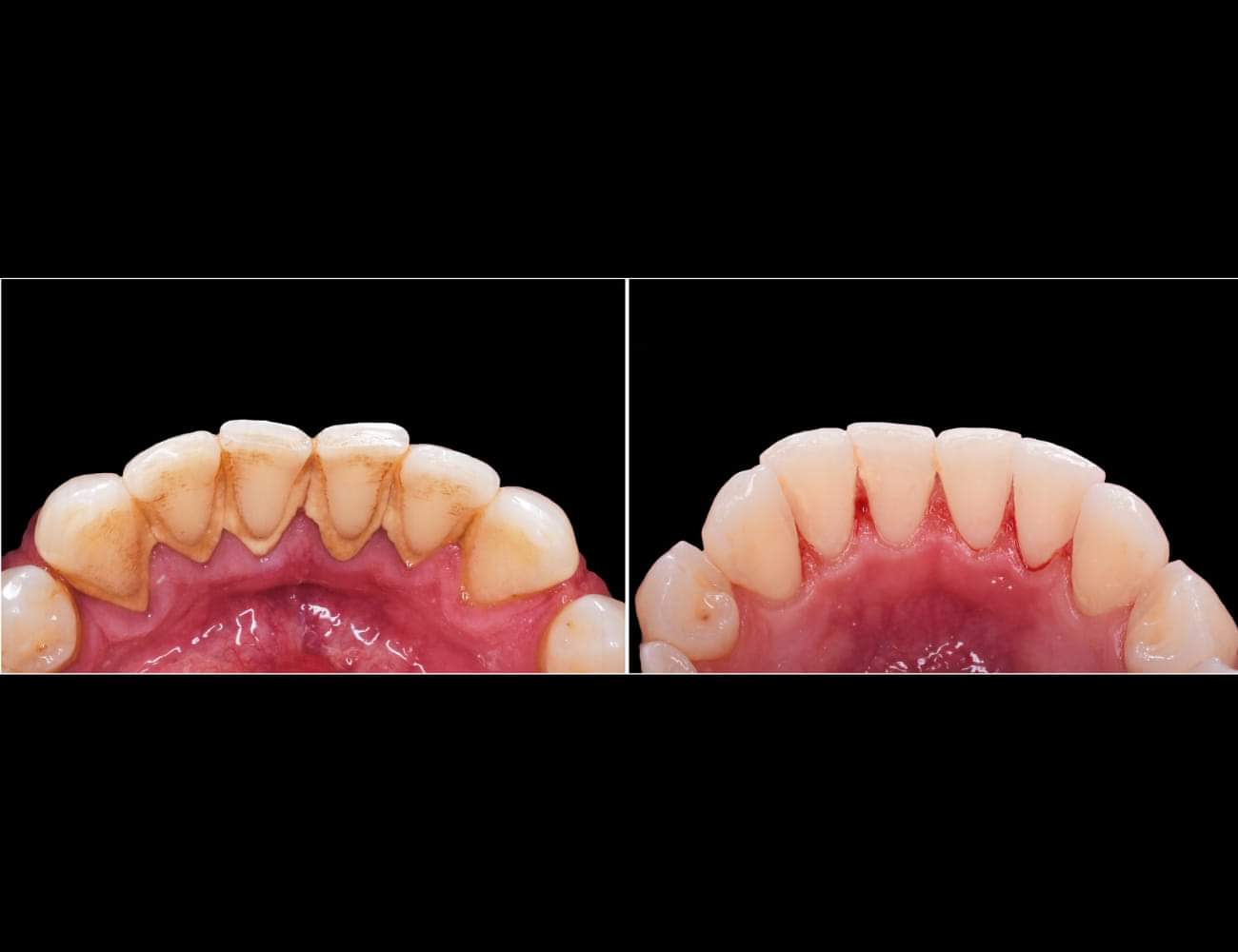 Demonstração Antes e Depois 3