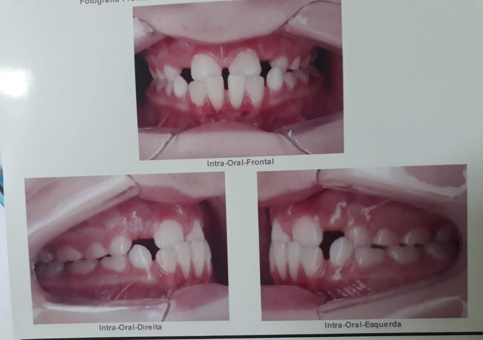 Demonstração Antes e Depois 5